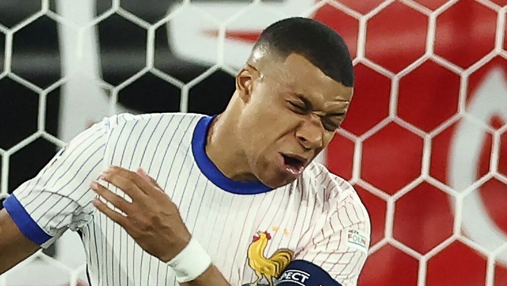 Mbappé nez cassé